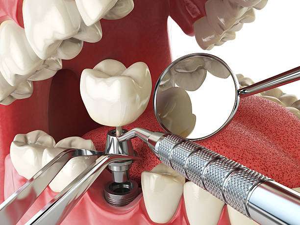 Best Emergency Gum Pain Relief  in Vancouver, WA